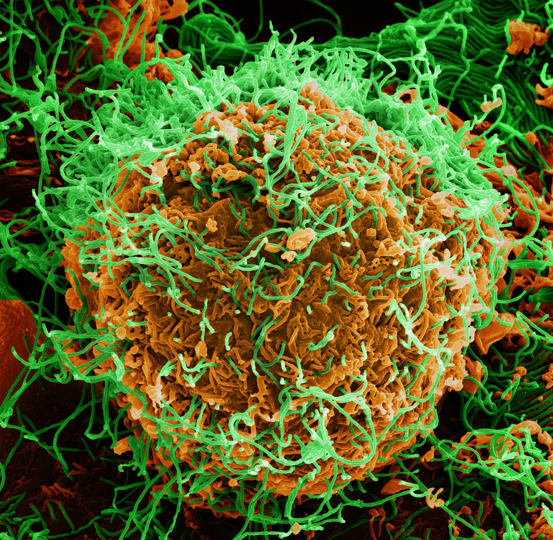 Colorized scanning electron micrograph of Ebola virus particles (green) both budding and attached to the surface of infected VERO E6 cells (orange). / Ebola